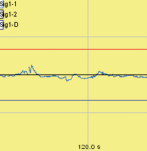 nerve activity before oil
